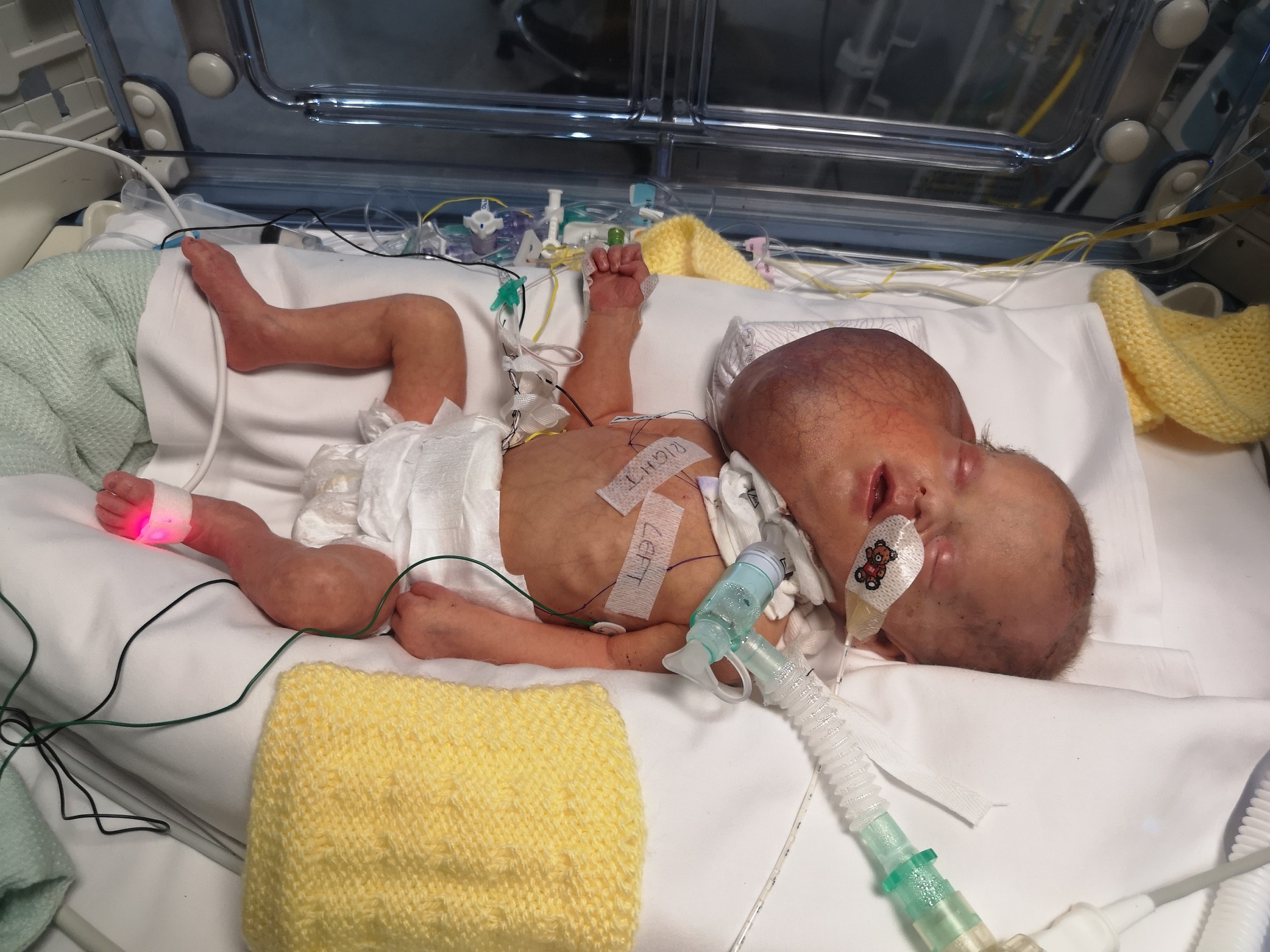 Photograph from Manchester University NHS Foundation Trust